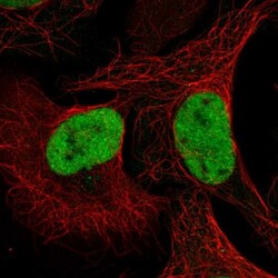 QRICH1 Antibody, Novus Biologicals:Antibodies:Primary Antibodies